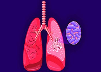 Community engagement for a TB-free nation