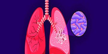 Community engagement for a TB-free nation