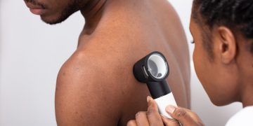 AbbVie and the University of Toronto support diversity in dermatology research, training and care