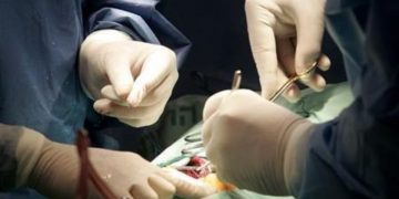 Pakistan: Hospital Staff Cut Off Newborn’s Head, Leave It Inside Mother’s Womb; Probe Ordered